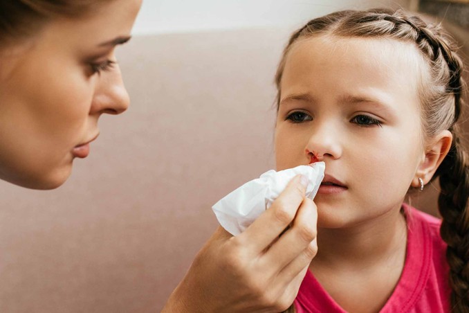 sangue che esce dal naso