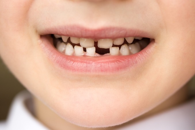 denti dei bambini