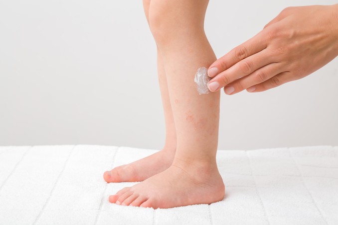 Come curare le piccole ferite