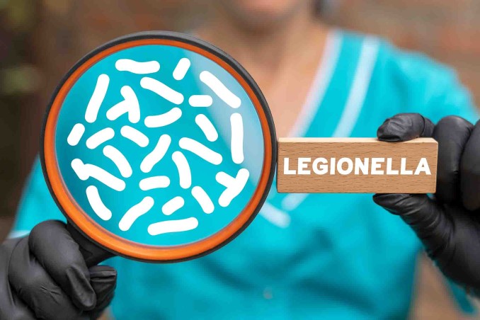 Legionella