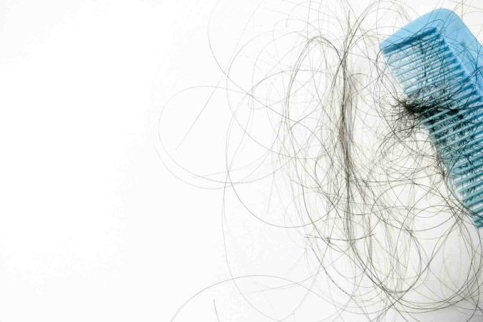 perdita e caduta di capelli