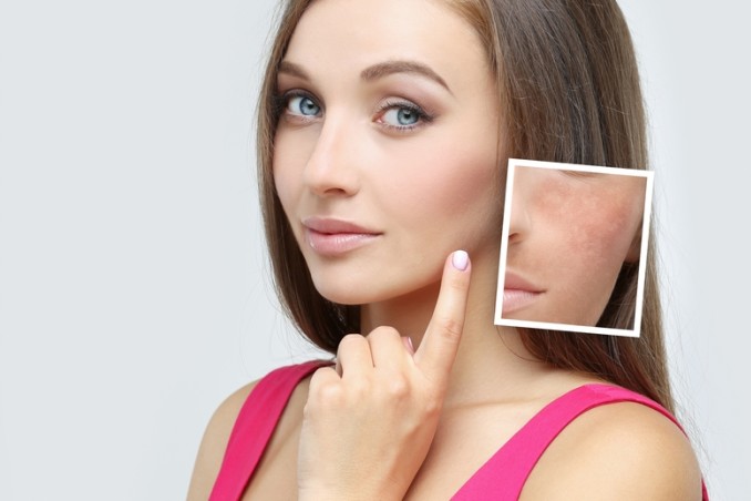 Macchie sul viso
